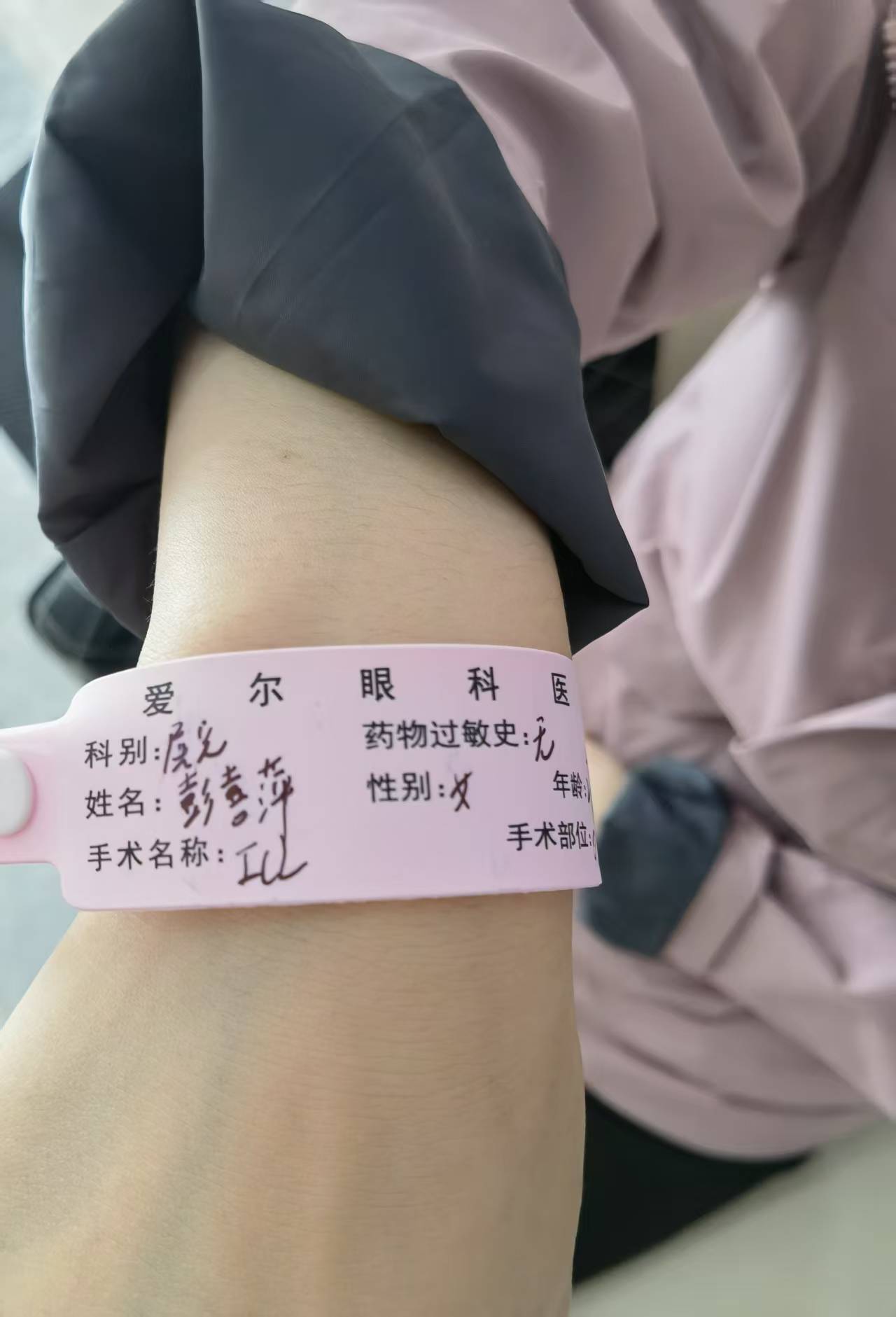 记录媳妇的近视矫正手术经历